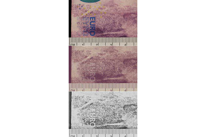 Before and After: Color Deconvolution and Convert to Grey. image